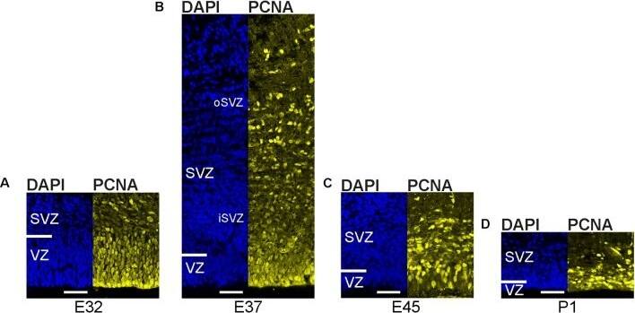 PCNA Antibody (PC10)
