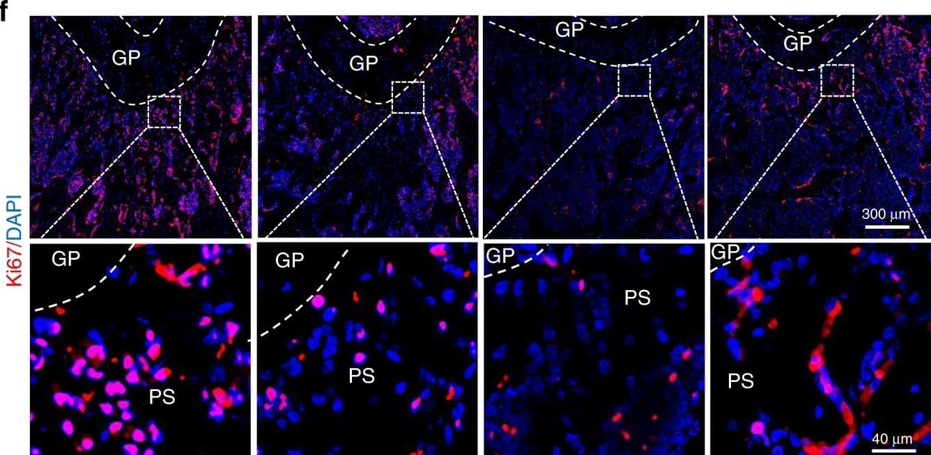 Ki67/MKI67 Antibody - BSA Free