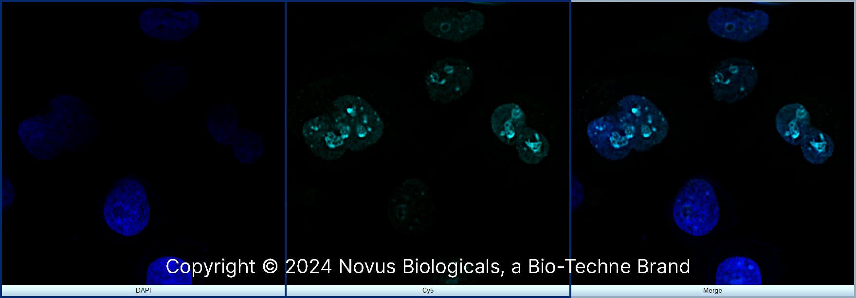 Ki67/MKI67 Antibody [DyLight 650]