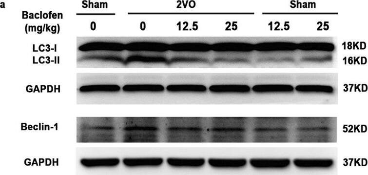 Beclin 1 Antibody - BSA Free