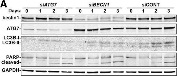 Beclin 1 Antibody - BSA Free
