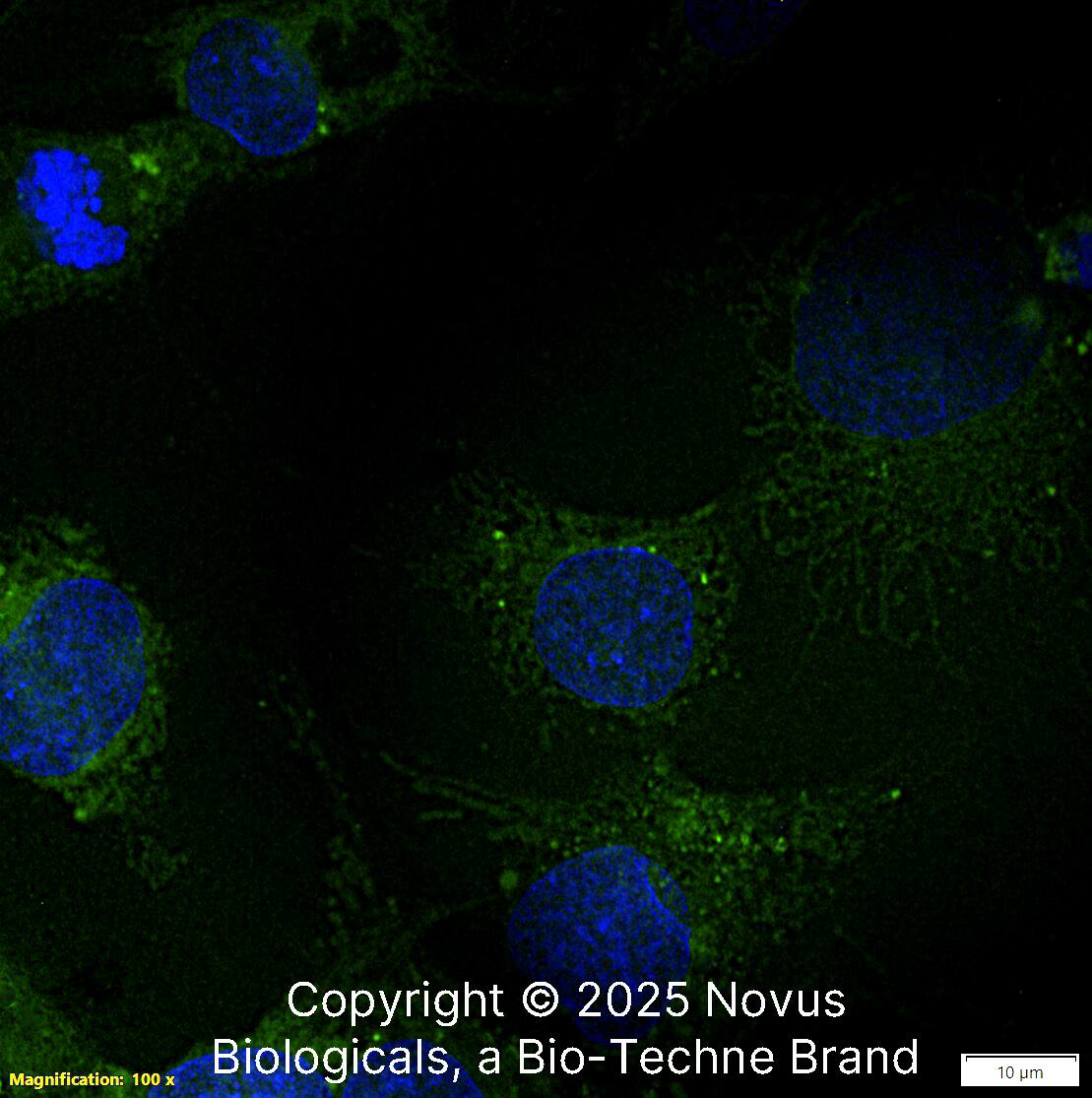 Beclin 1 Antibody [FITC]