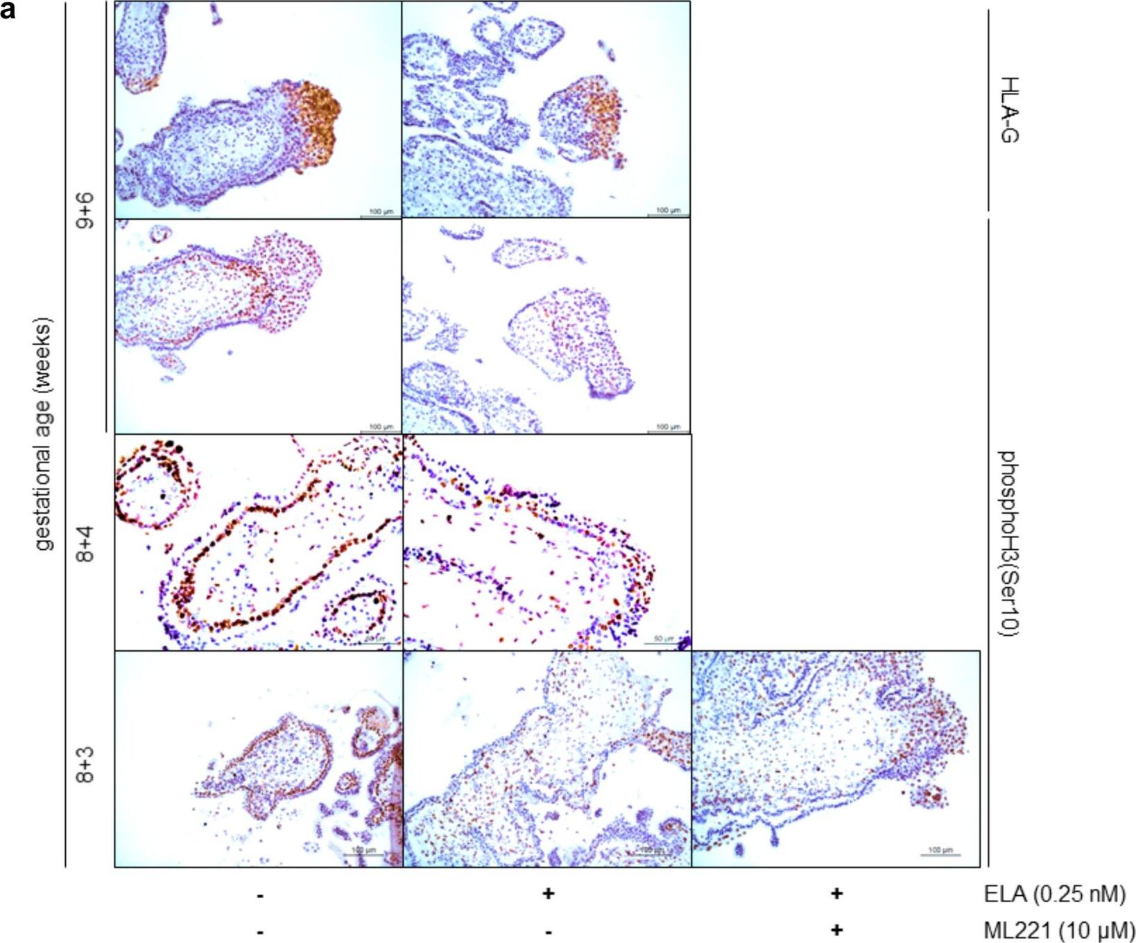 HLA G Antibody (MEM-G/1) - BSA Free