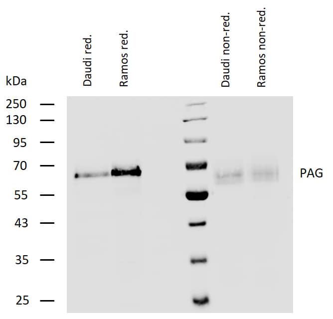 PAG1 Antibody Western Blot: PAG1 Antibody [NB500-541]