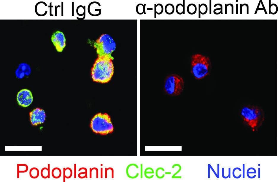 Podoplanin Antibody (8.1.1) - BSA Free
