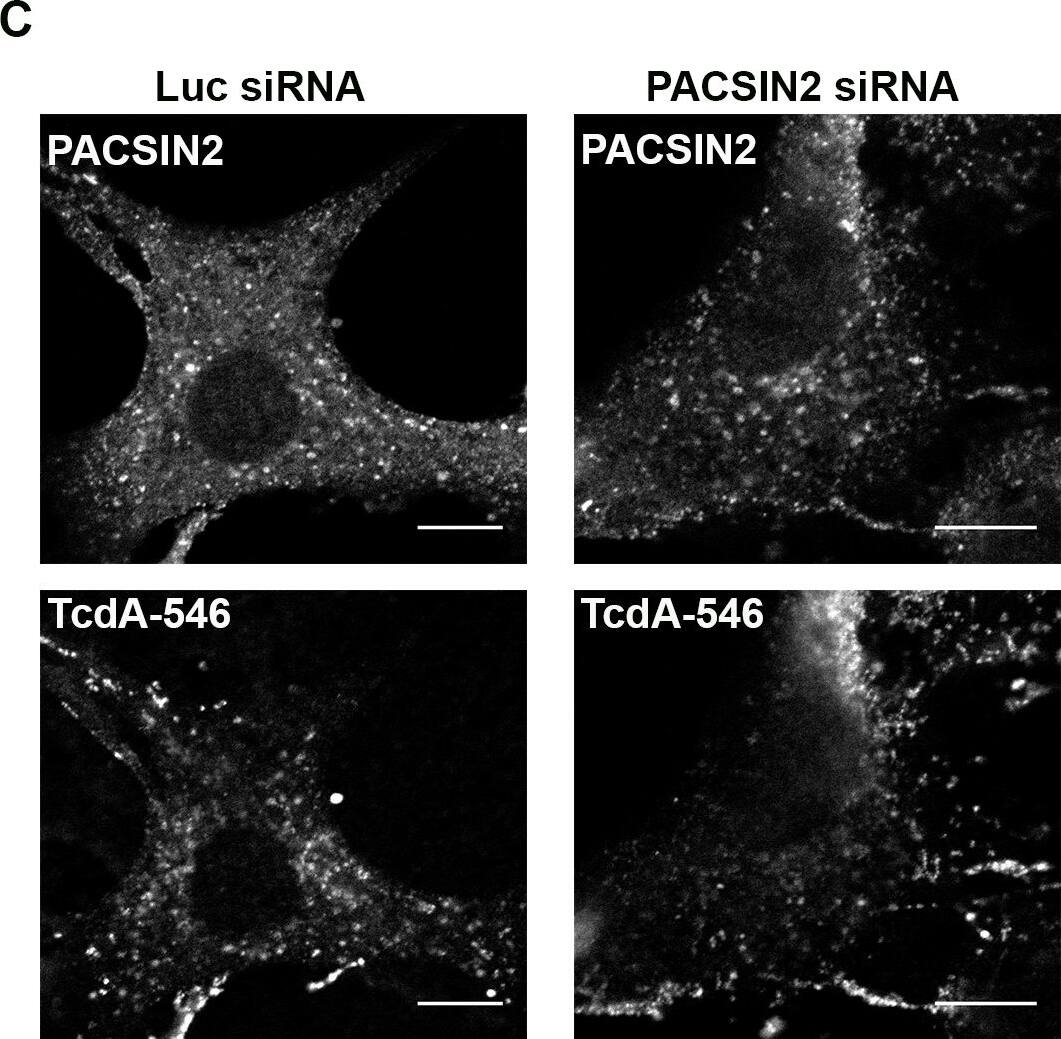 Clostridium Difficile Toxin A Antibody (PCG4.1) - BSA Free