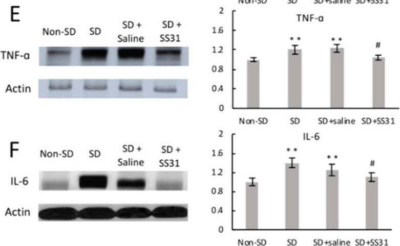 IL-6 Antibody - Azide and BSA Free