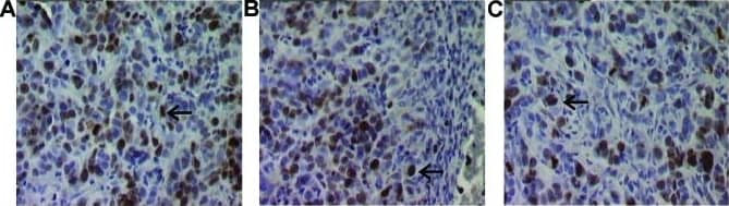 Ki67/MKI67 Antibody (SP6) - Unpurified