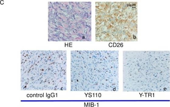 Ki67/MKI67 Antibody (SP6) - Unpurified