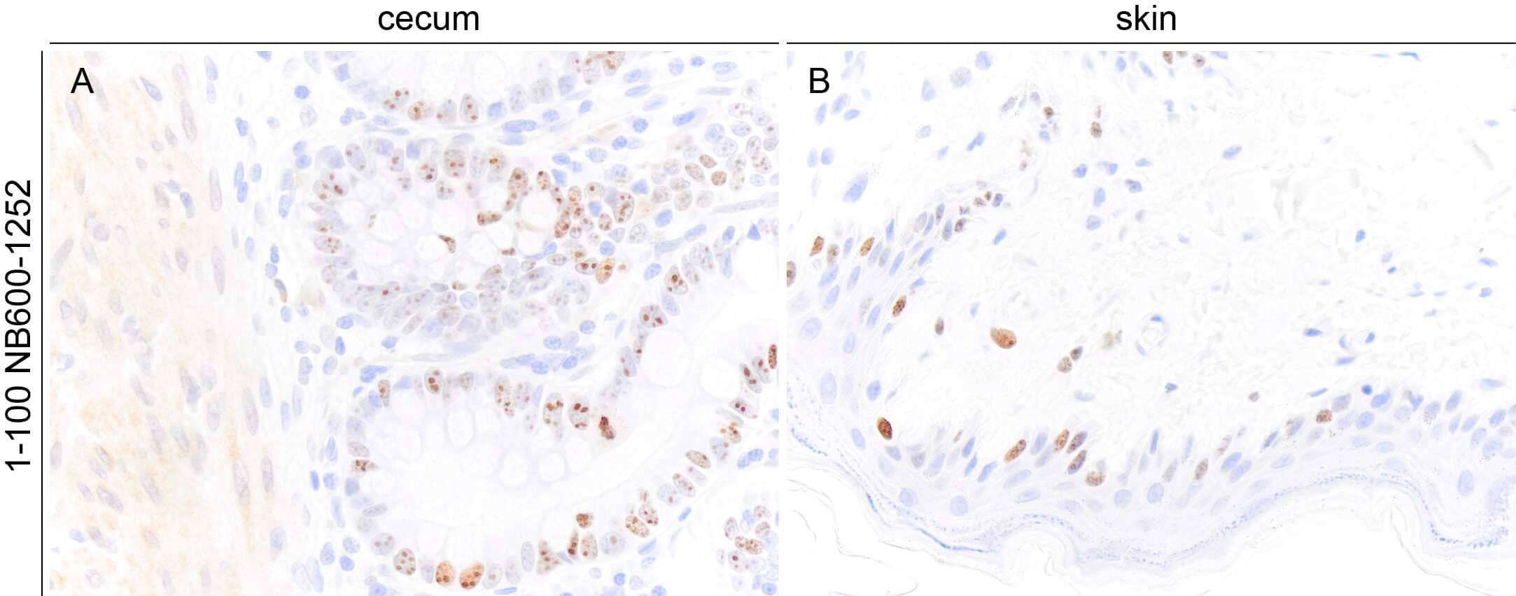 ガビ β-Catenin (D10A8) XP® Rabbit mAb | Cell Signaling Technology
