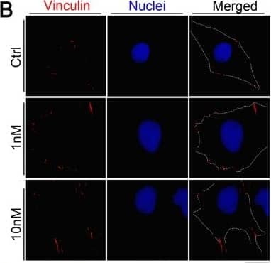 Vinculin Antibody (hVIN-1)