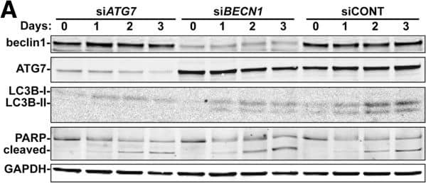 LC3B Antibody - BSA Free