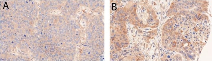 LC3B Antibody - BSA Free