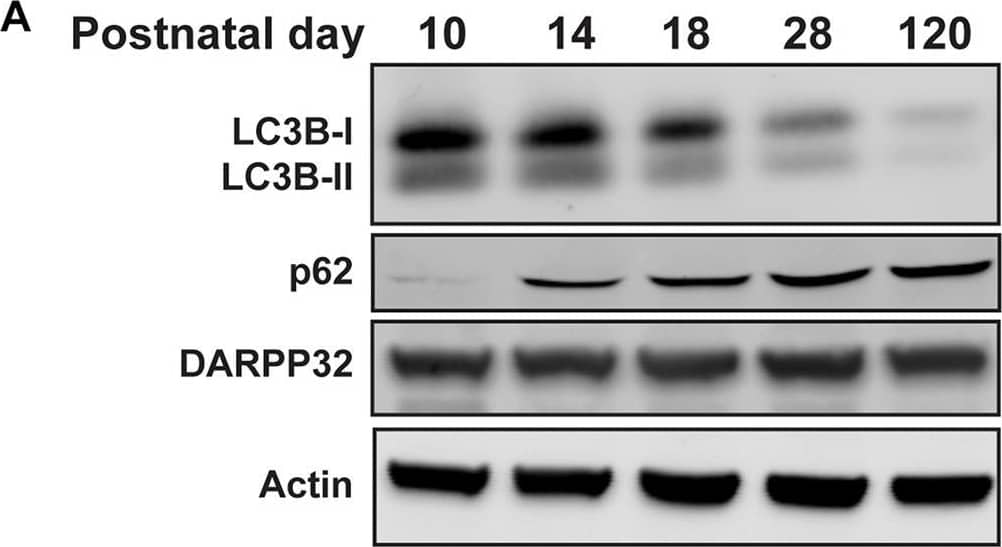 LC3B Antibody - BSA Free