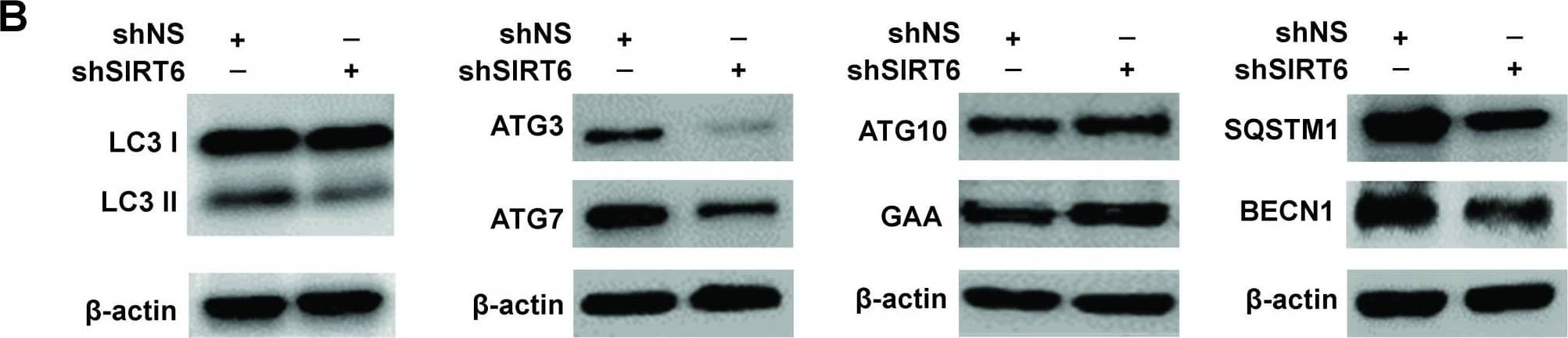 LC3B Antibody - BSA Free