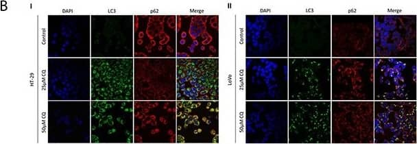 LC3B Antibody - BSA Free
