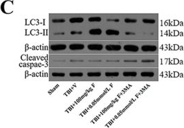LC3B Antibody - BSA Free