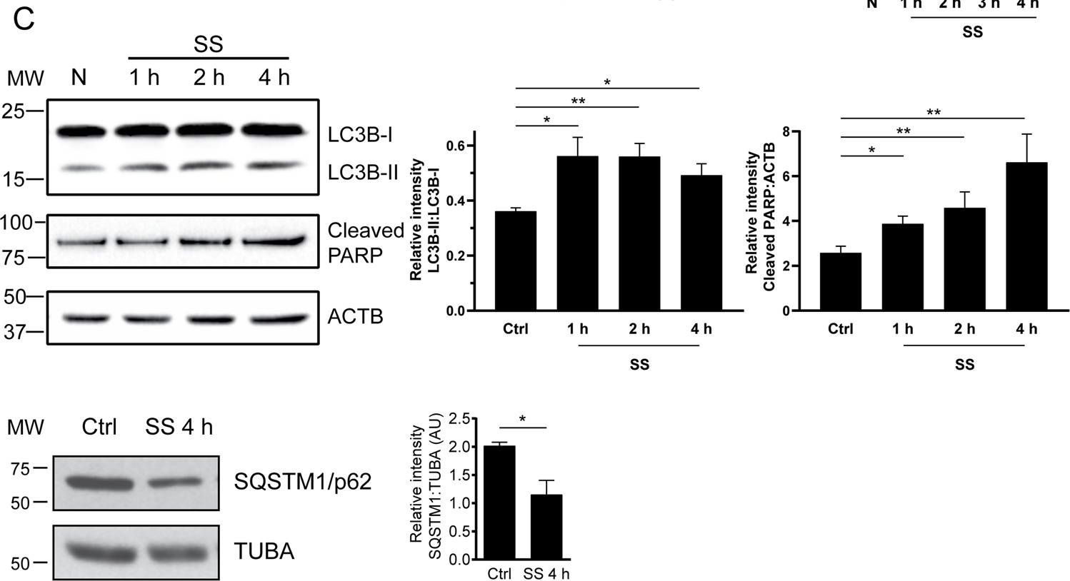 LC3B Antibody - BSA Free