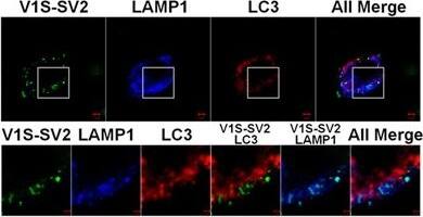 LC3B Antibody - BSA Free