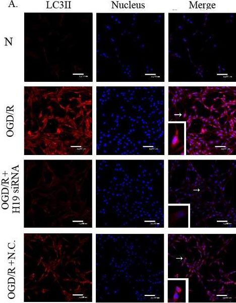 LC3B Antibody - BSA Free