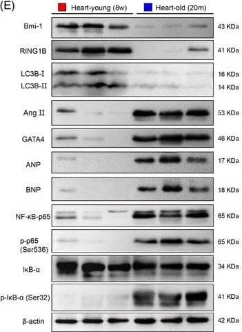 LC3B Antibody - BSA Free