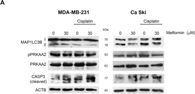 LC3B Antibody - BSA Free