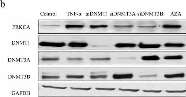 PKC alpha Antibody (MC5) - BSA Free