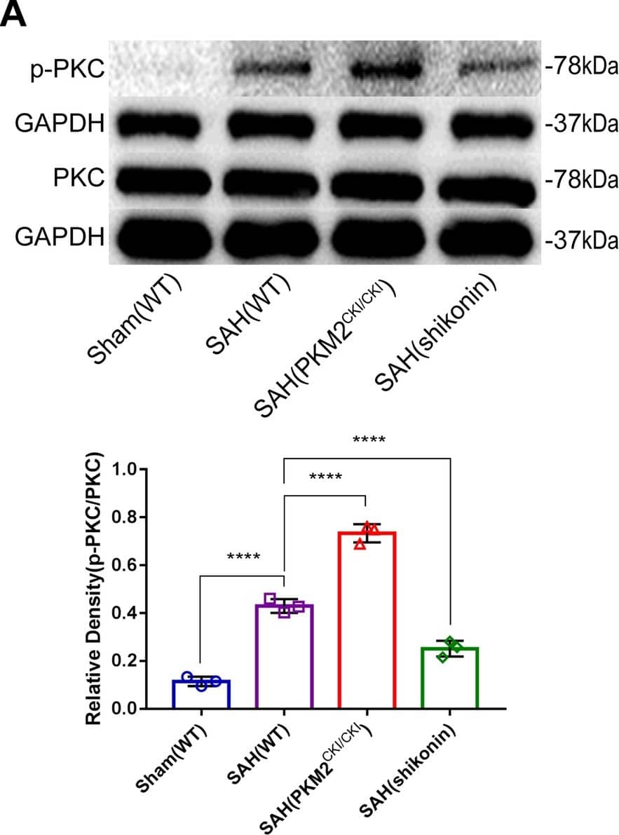PKC alpha Antibody (MC5) - BSA Free