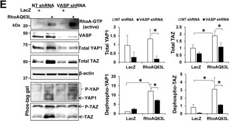 TAZ/WWTR1 Antibody - BSA Free