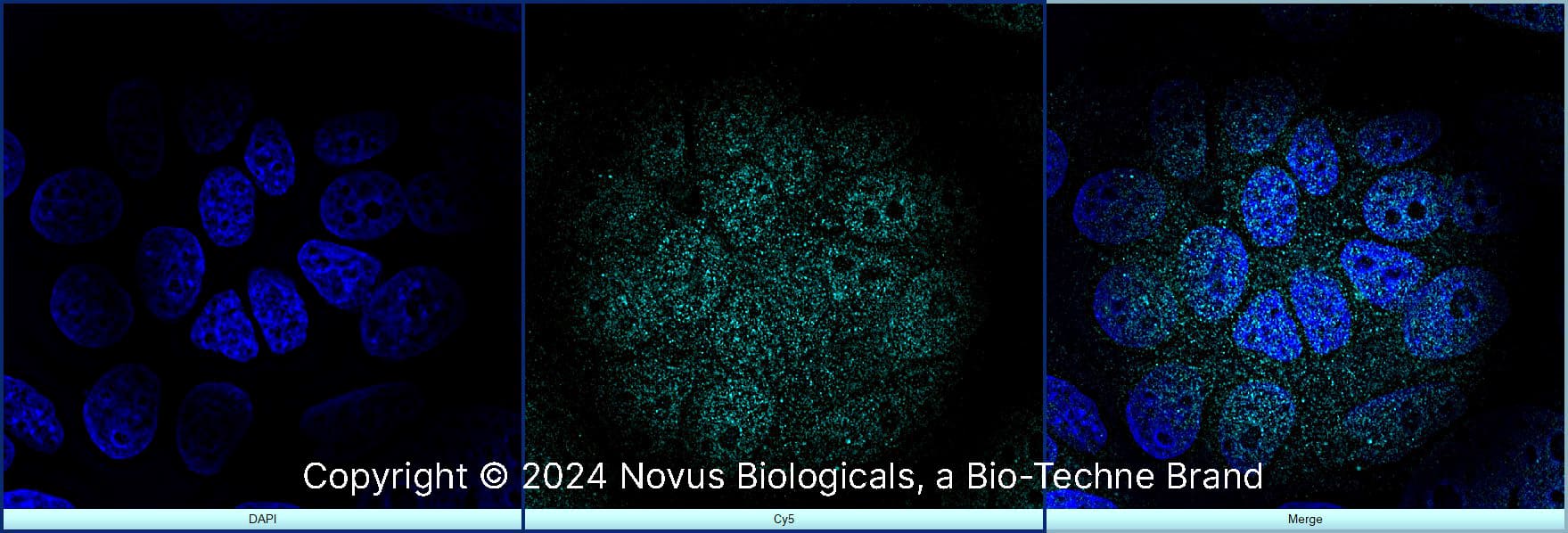 FoxP3 Antibody [Alexa Fluor® 647]