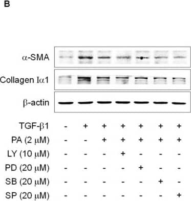 Collagen I Antibody