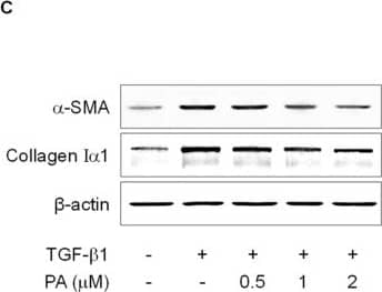 Collagen I Antibody