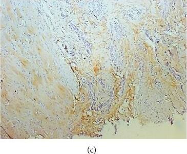 Collagen I alpha 1 Antibody (COL-1)