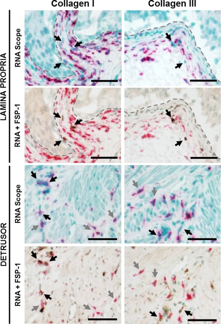 Collagen I alpha 1 Antibody (COL-1)