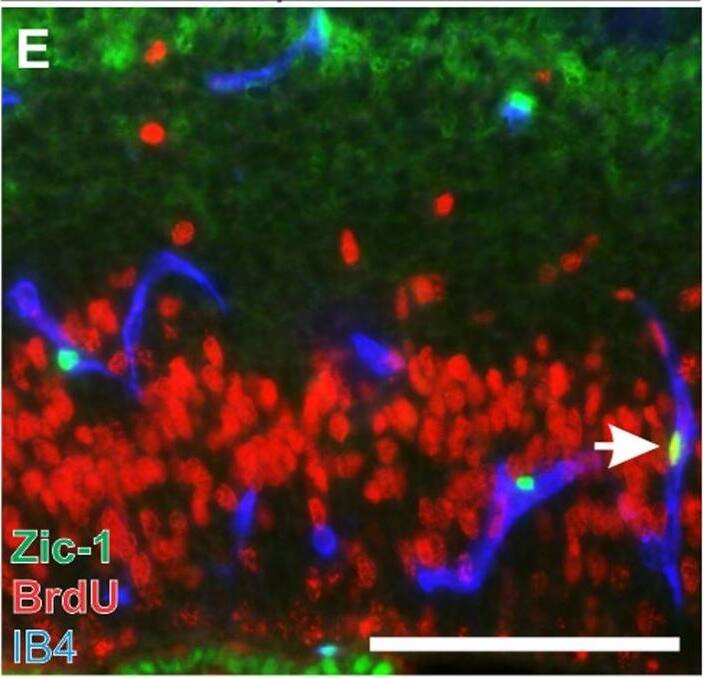 ZIC1 Antibody - BSA Free