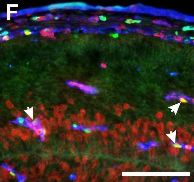 ZIC1 Antibody - BSA Free