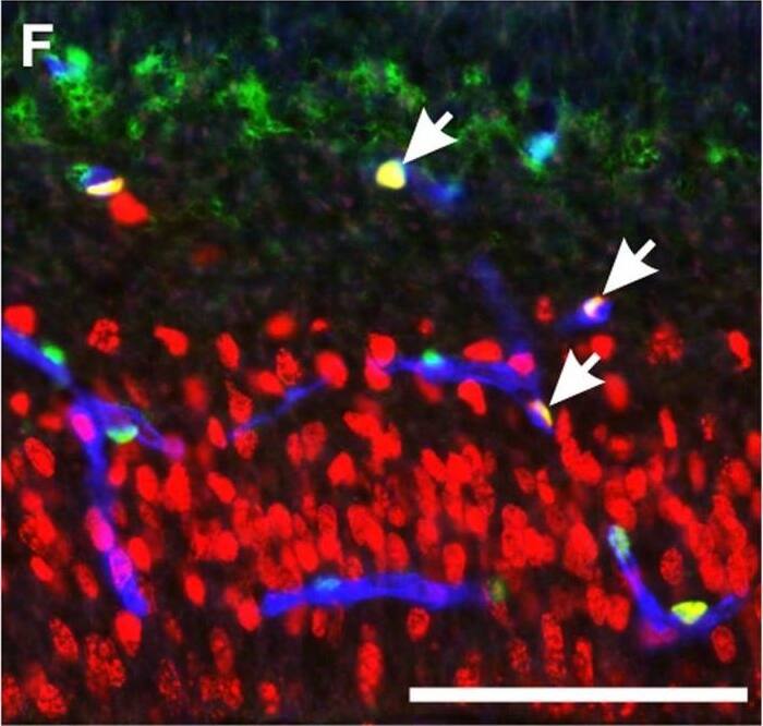 ZIC1 Antibody - BSA Free