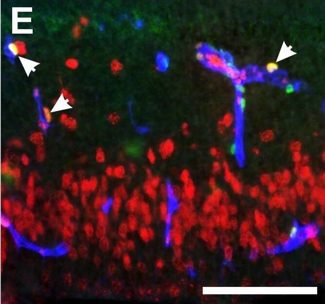 ZIC1 Antibody - BSA Free
