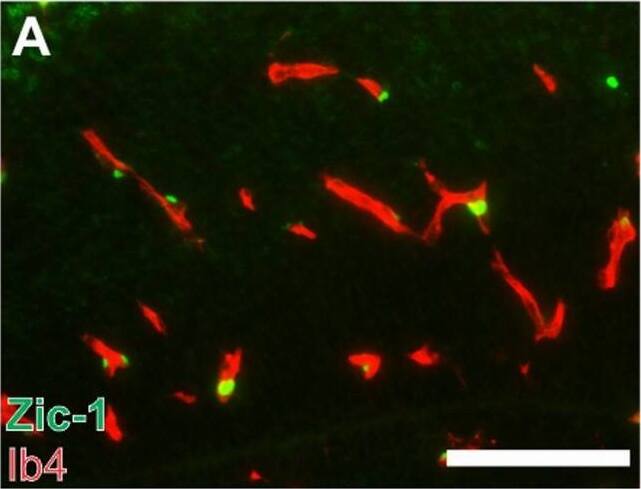ZIC1 Antibody - BSA Free