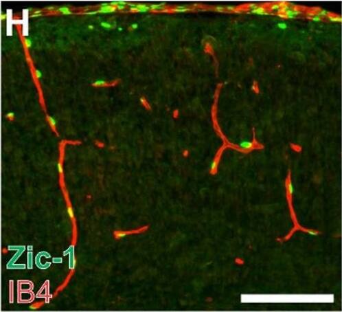ZIC1 Antibody - BSA Free