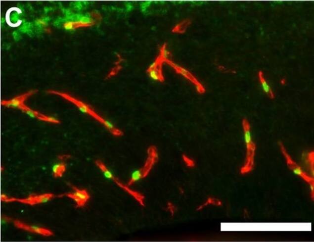 ZIC1 Antibody - BSA Free