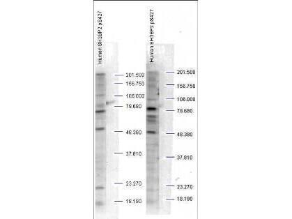 SH3BP2 [p Ser427] Antibody