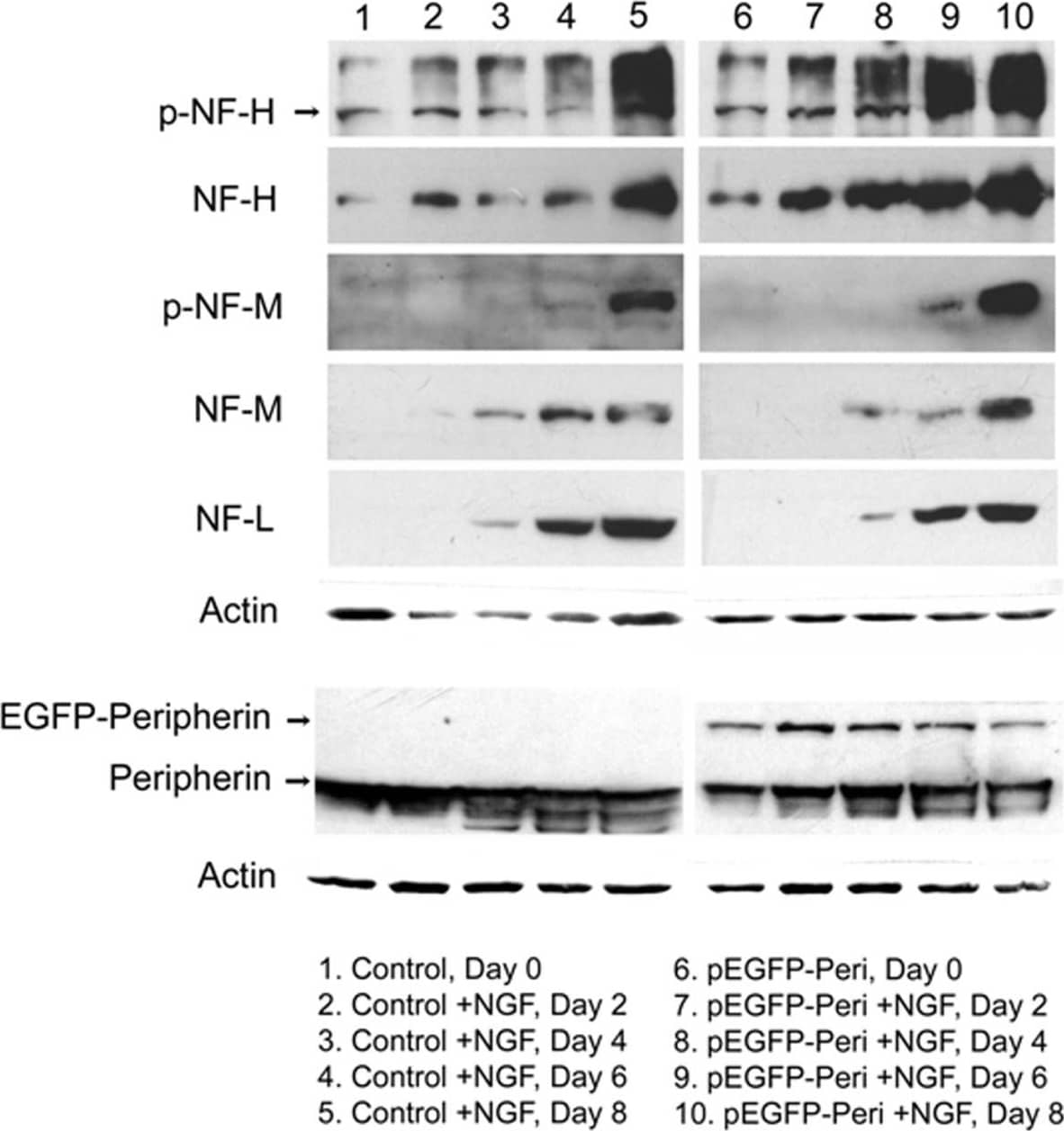 beta-Actin Antibody (AC-15)