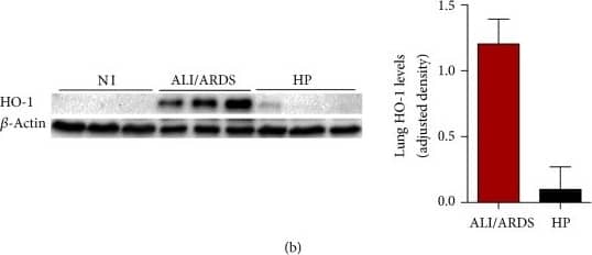 beta-Actin Antibody (AC-15)