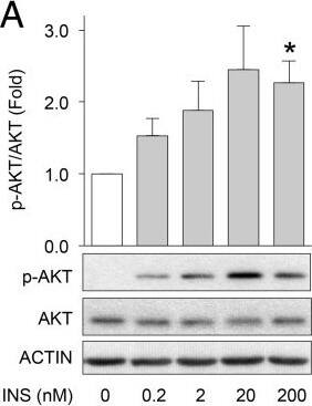 beta-Actin Antibody (AC-15)