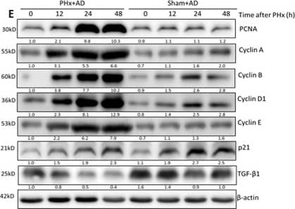 beta-Actin Antibody (AC-15)