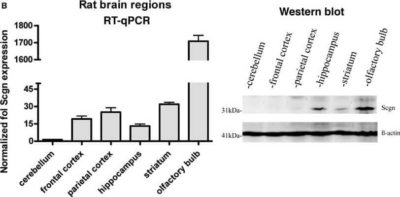 beta-Actin Antibody (AC-15)