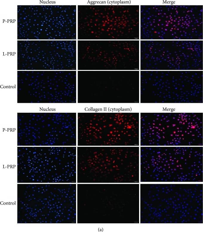 Aggrecan Antibody (BC-3) - BSA Free