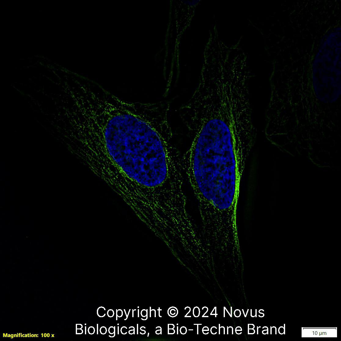 alpha Tubulin Antibody (YL1/2) [DyLight 488]