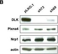Actin Gamma 1 Antibody